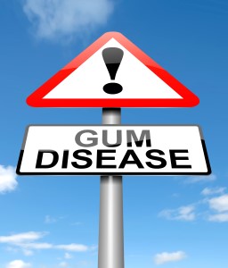 Illustration depicting a sign with a Gum disease concept.