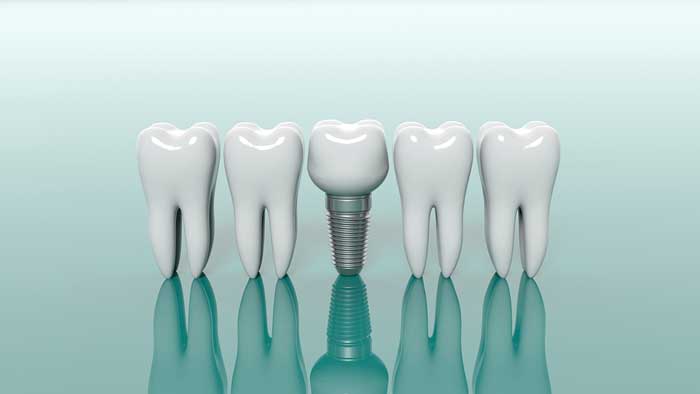 Illustration of teeths